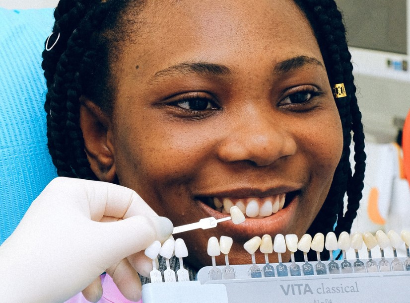 Veneers: Pioneering New Avenues in Personalised Dental Restoration